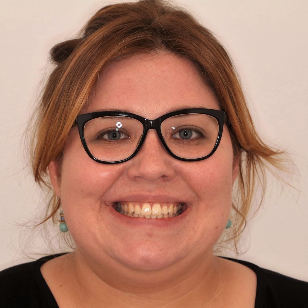 meagan ní chuirc invisalign after
